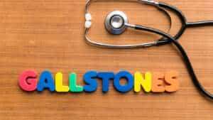 Preventing Gallstones: Diet Tips by Dr Nivedita Pandey