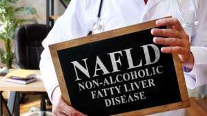 Non Alcoholic Fatty Liver Disease Symptoms