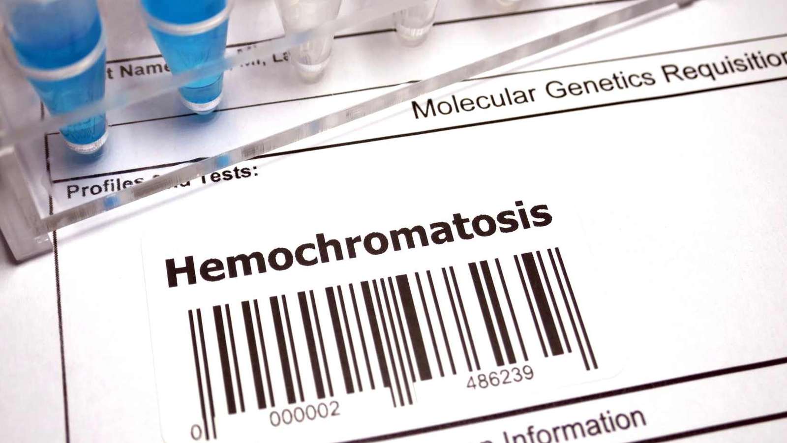 causes of hemochromatosis