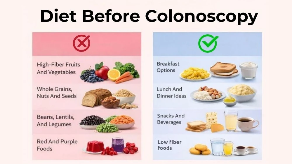 Diet Before Colonoscopy