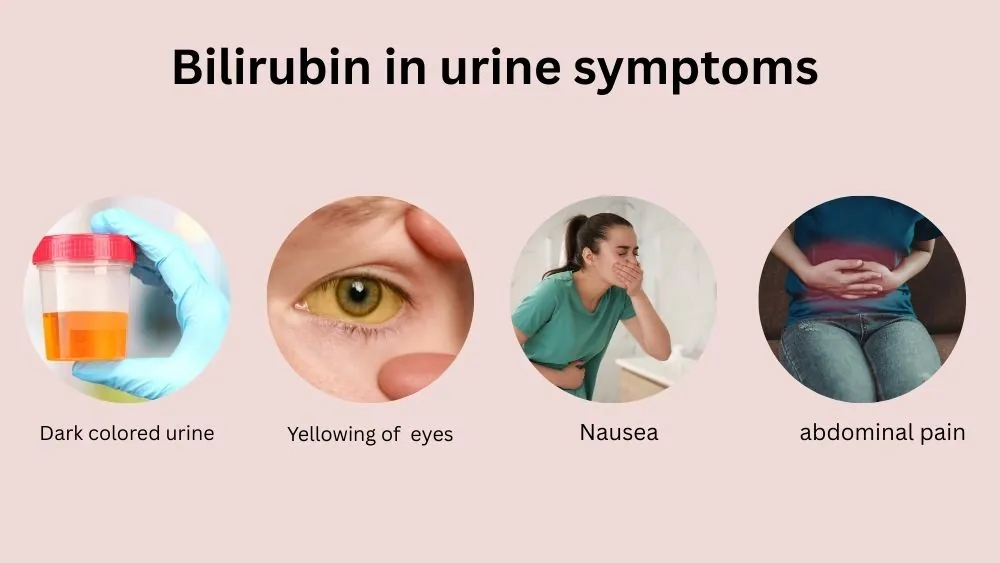 Bilirubin In Urine Symptoms
