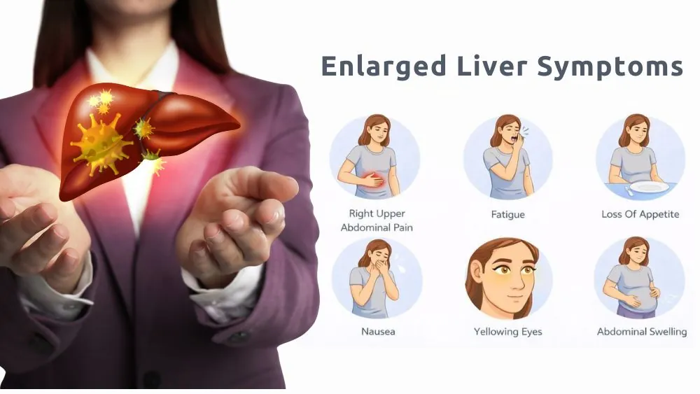 Enlarged Liver Symptoms