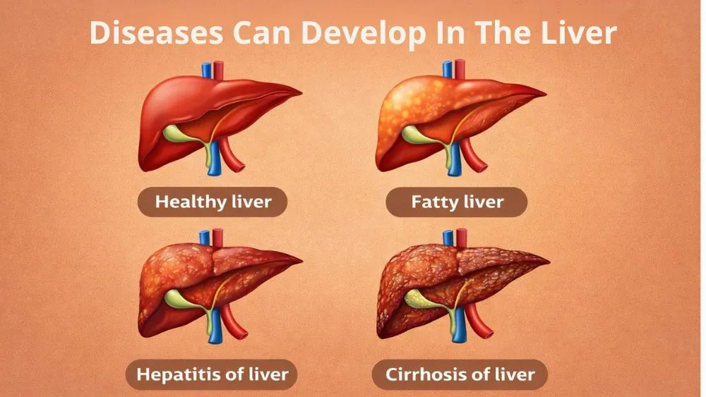 What Diseases Can Develop In The Liver