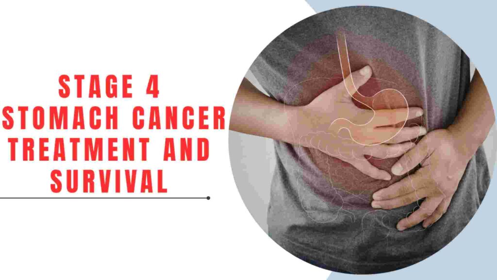 Stomach Cancer Survival Rates: By Stage, Affected, and Treatment 2 Stage-Wise Survival Treatment Strategies