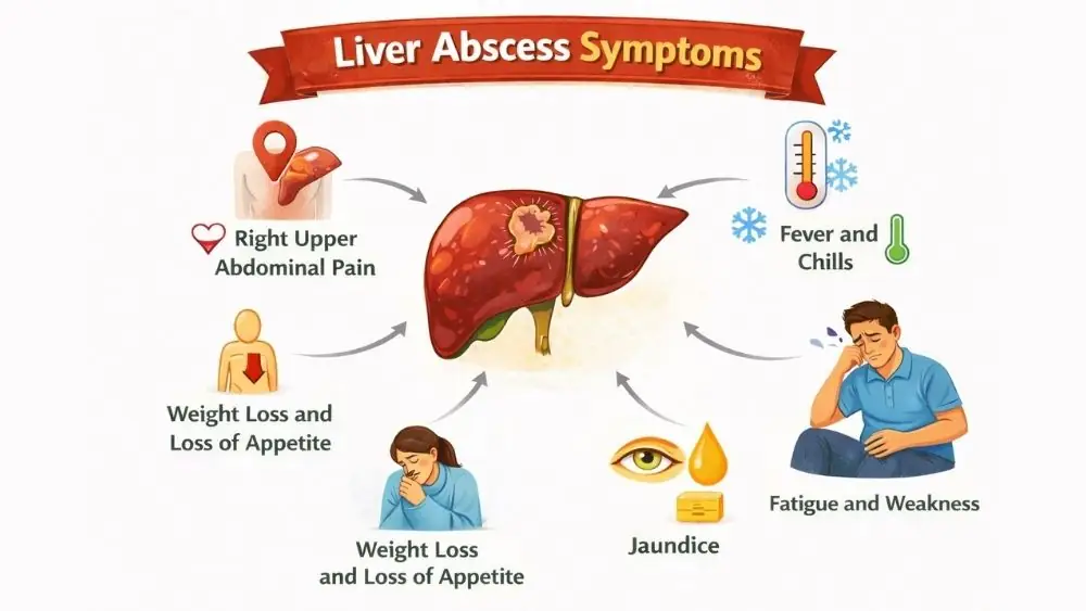 Liver Abscess: Symptoms, Causes, and Treatment 2 Liver Abscess Symptoms