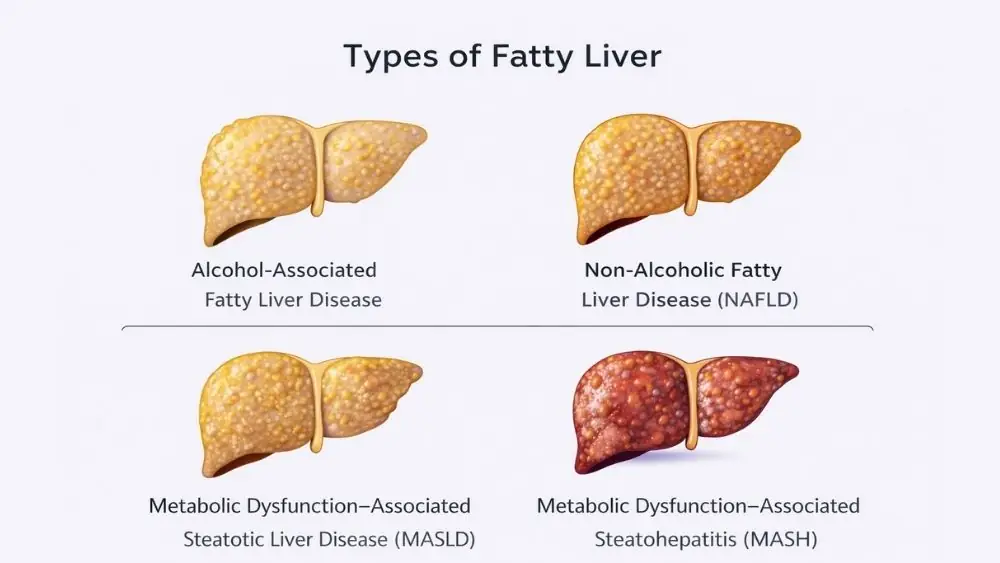 Diffuse Hepatic Steatosis: Causes, Symptoms, and Treatment 2 Types Of Fatty Liver Disease
