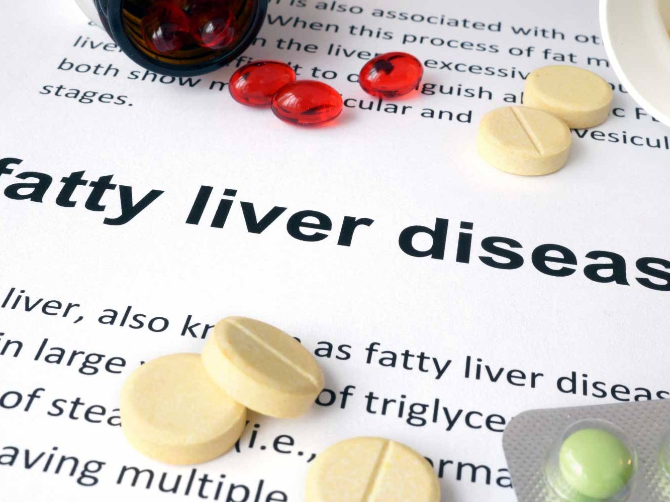 Non-alcoholic-Fatty-Liver-Disease-Symptoms