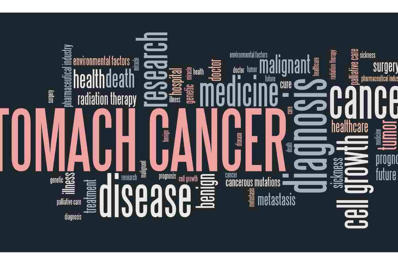 Stages of stomach cancer and treatment 10 Stages of stomach cancer and treatment