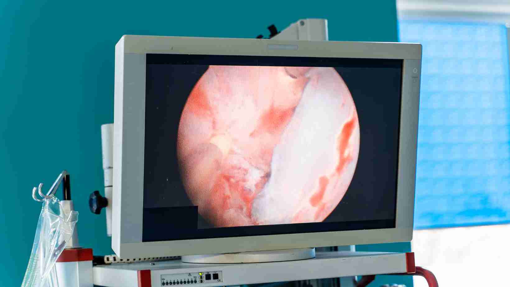 Use of endoscopes in surgery