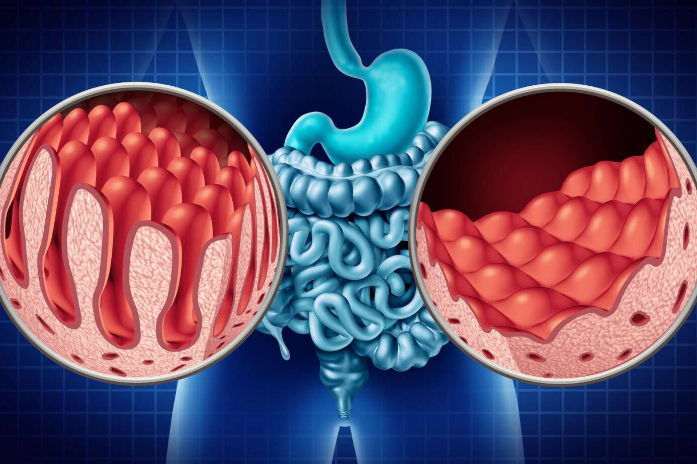 healthy digestive system