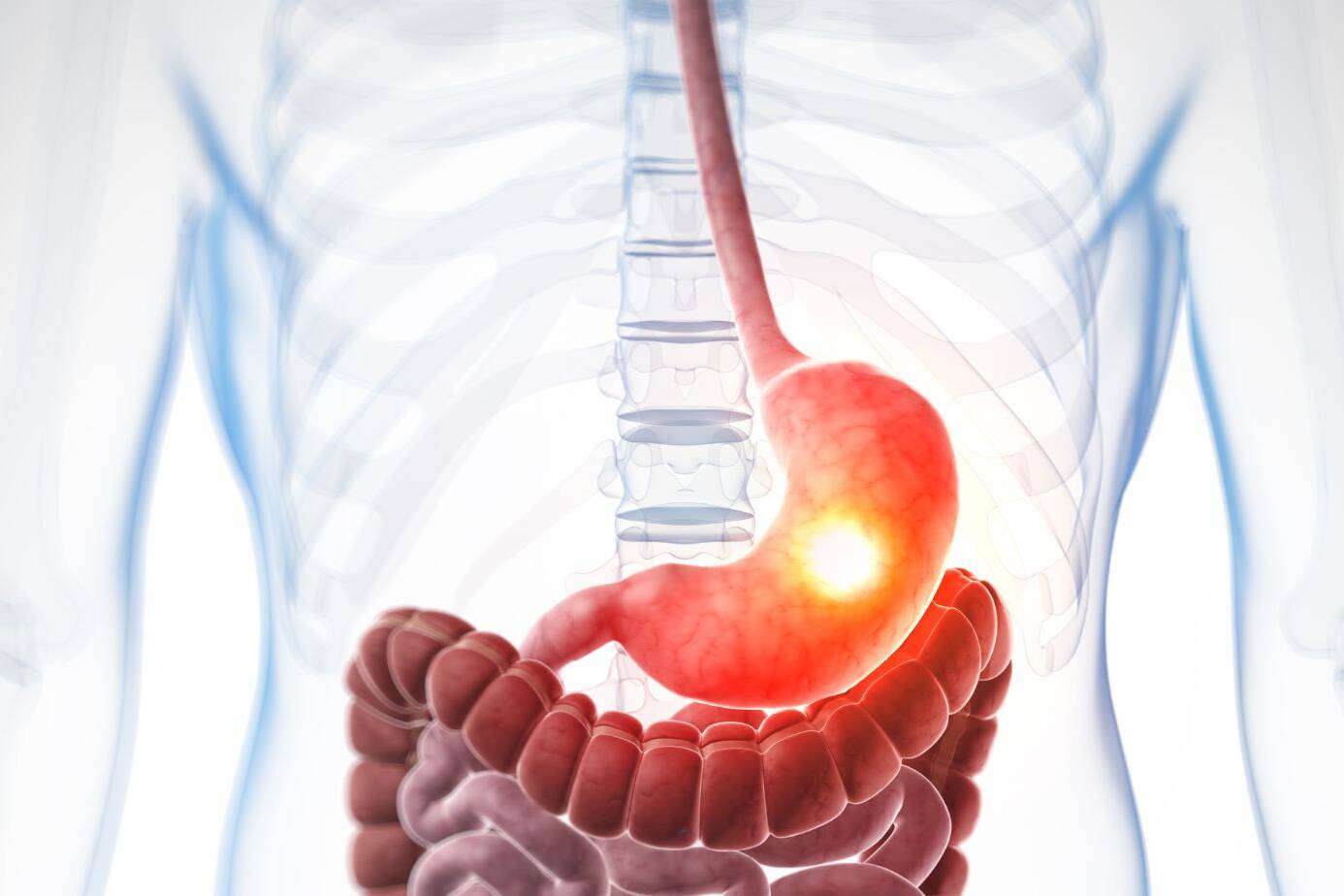 Effective Barrett's Esophagus Treatment Options 5