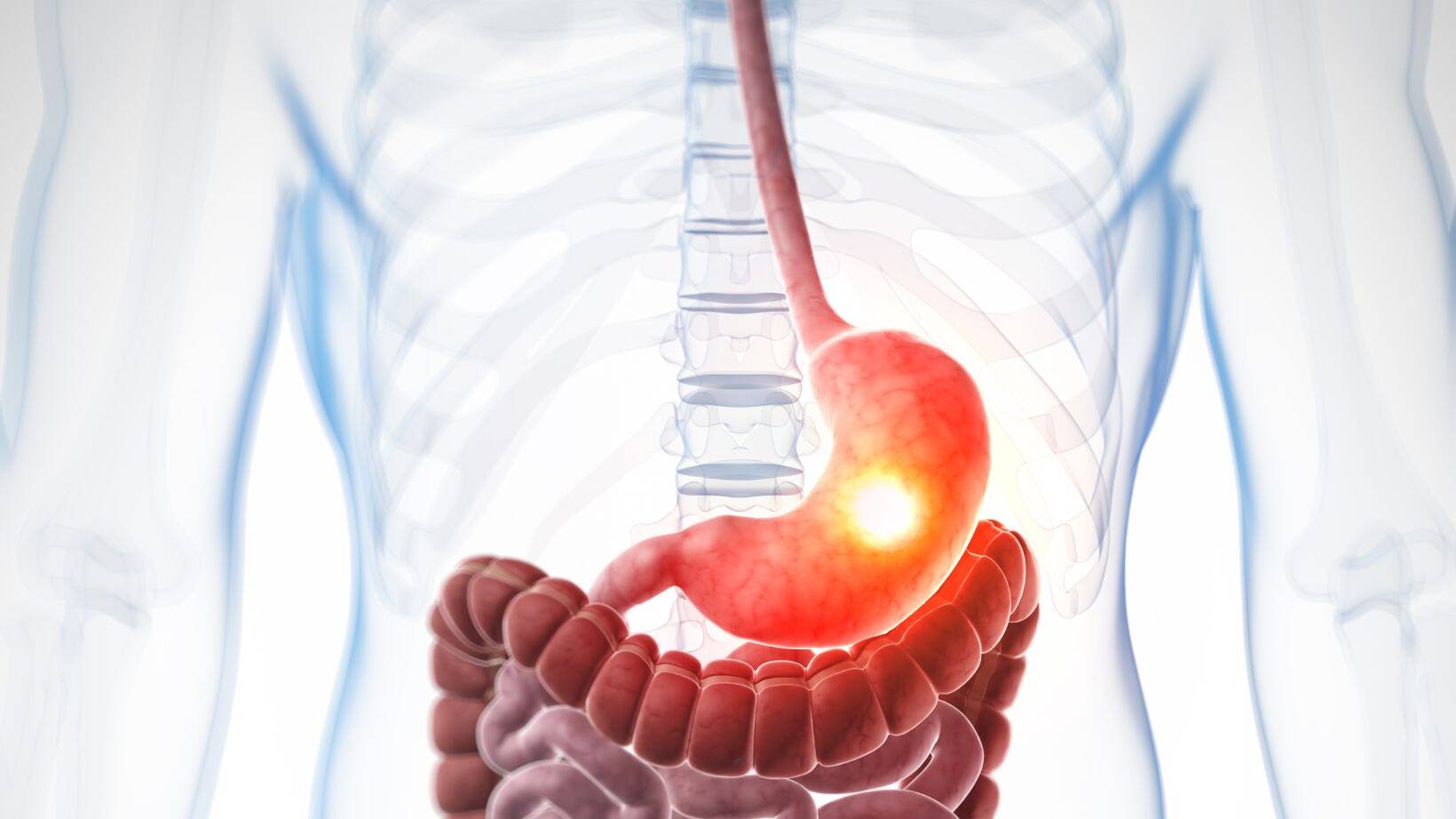 Effective Barrett's Esophagus Treatment Options 13