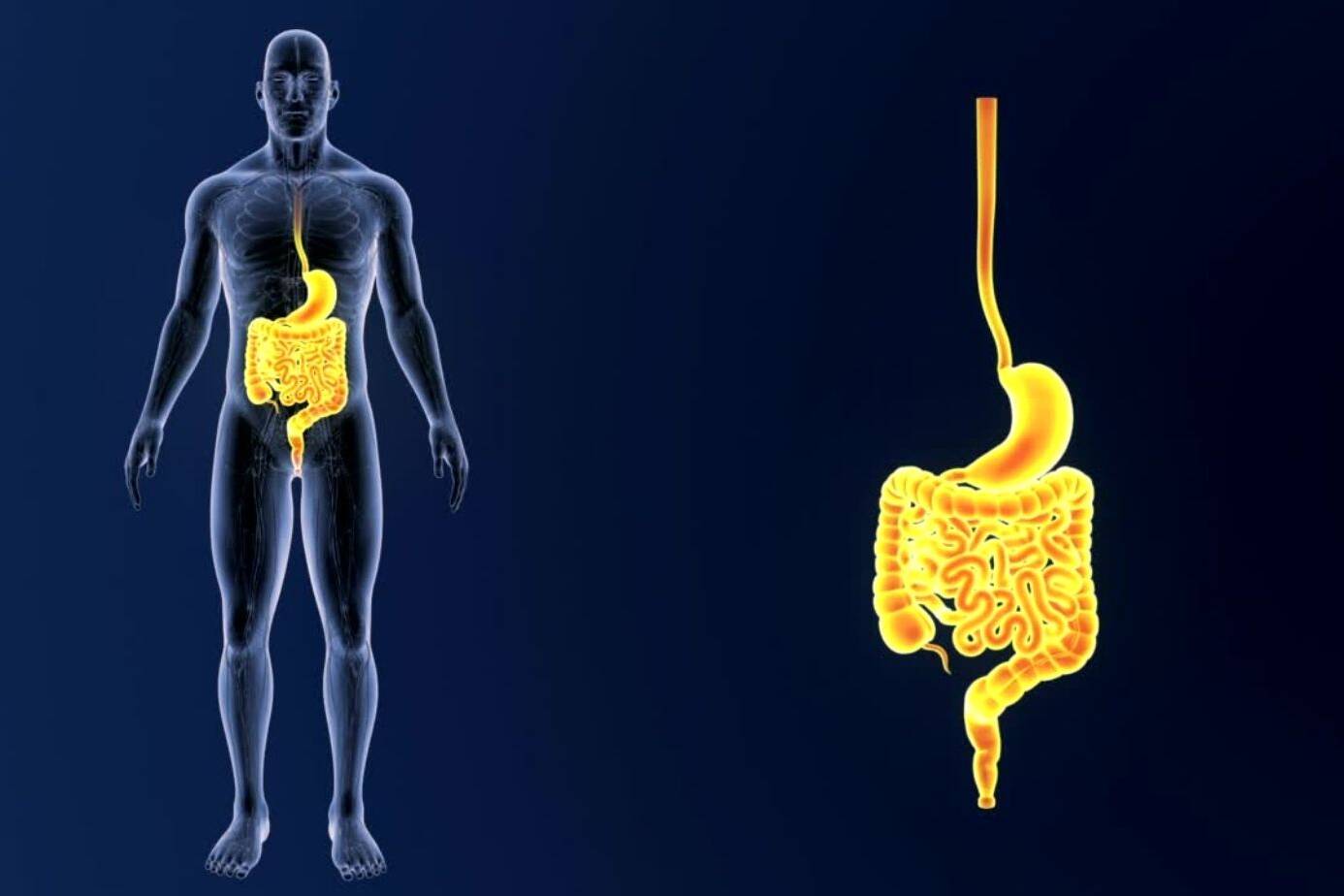 Understanding Barrett's Esophagus with Dysplasia 9 Barrett's Esophagus