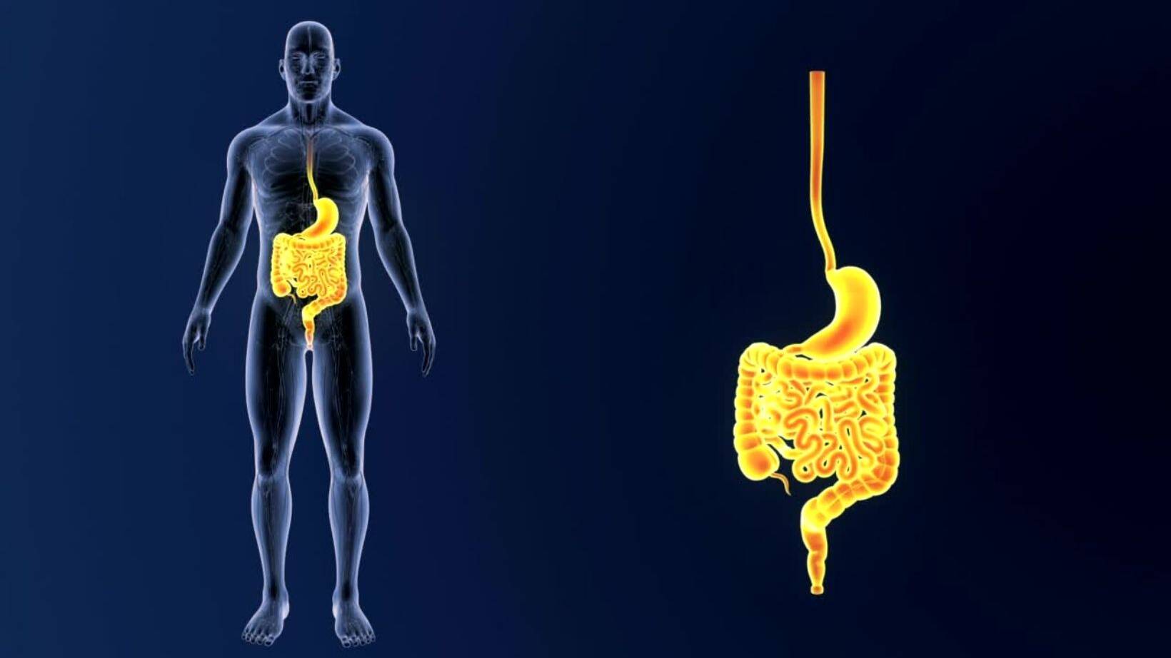 Understanding Barrett's Esophagus with Dysplasia 12 Barrett's Esophagus
