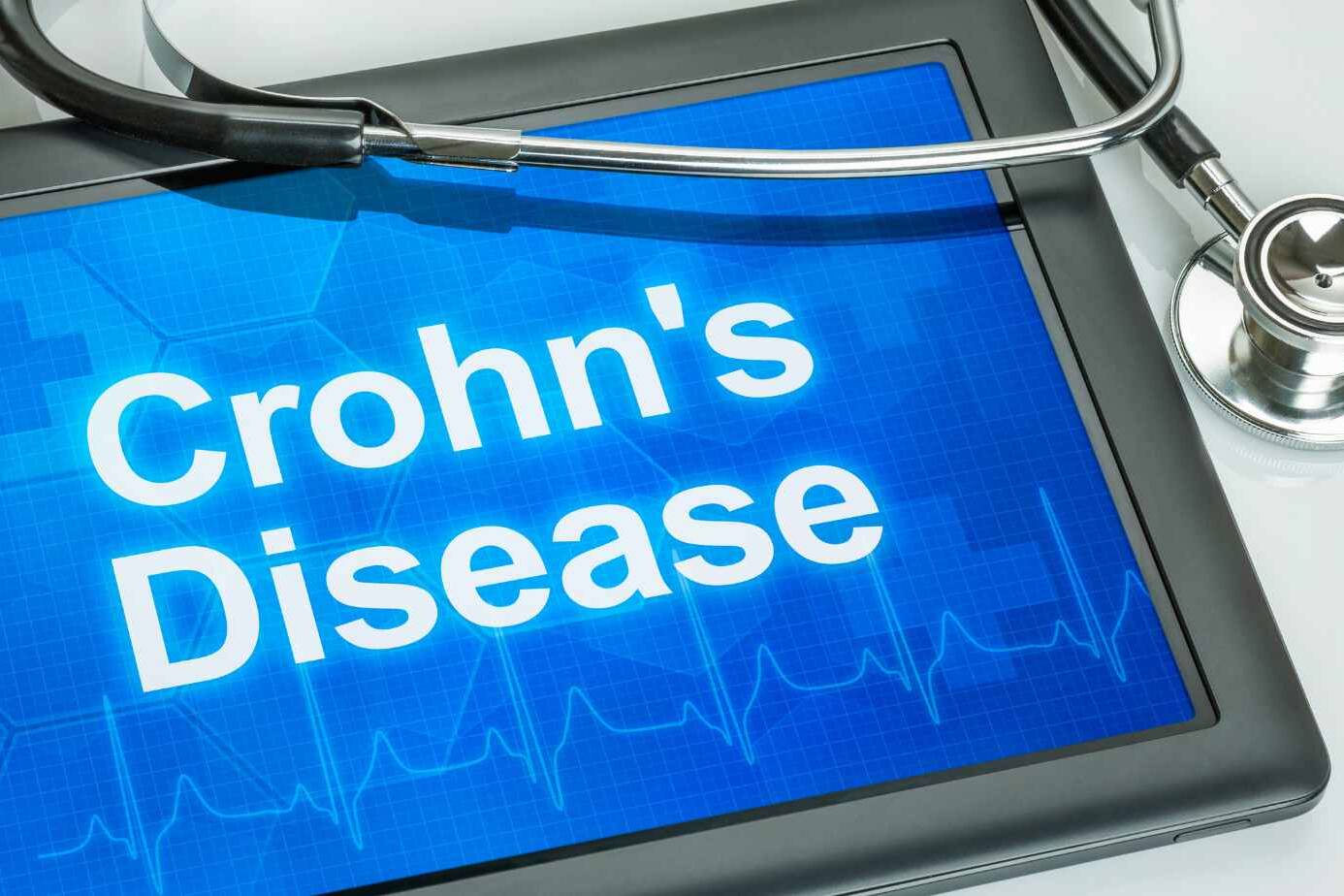 Association with Crohn's Disease