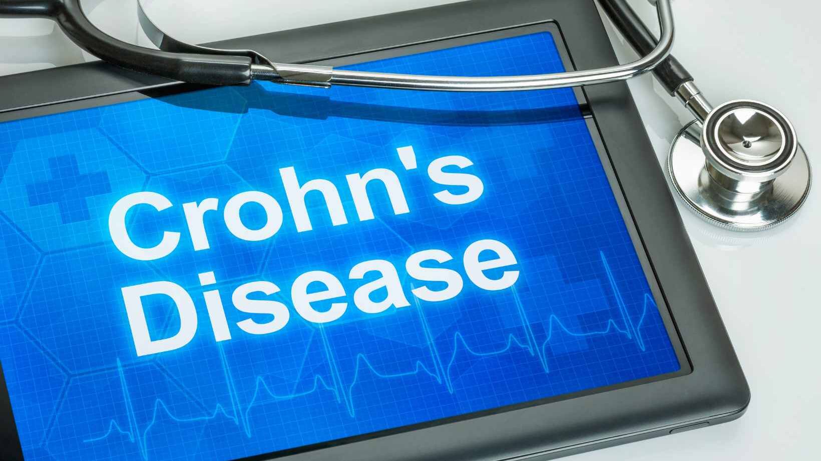 Understanding Association with Crohn's Disease 13 Association with Crohn's Disease