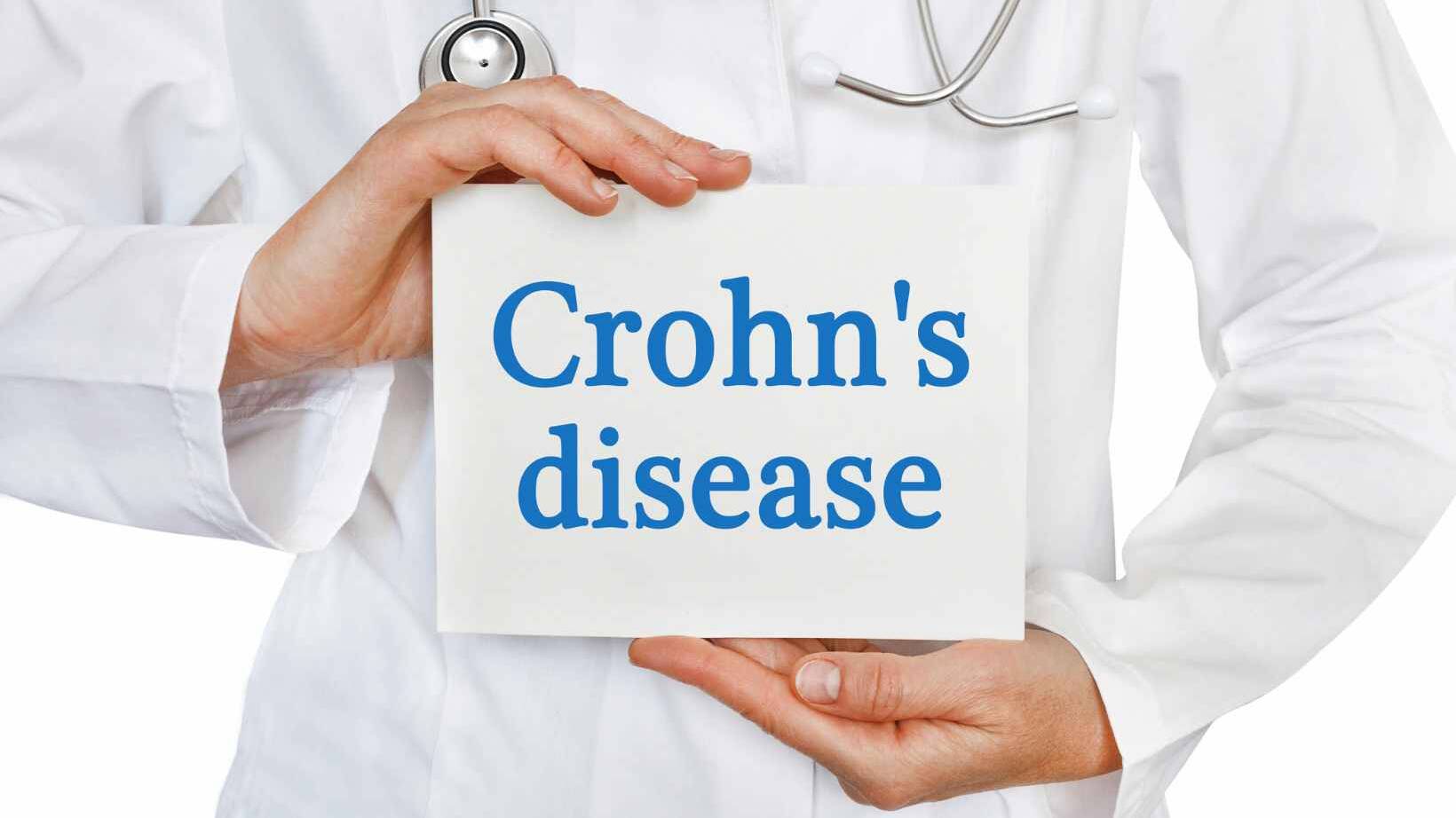 Can Crohn's Disease Cause Constipation? Find Out! 15 can crohn's disease cause constipation