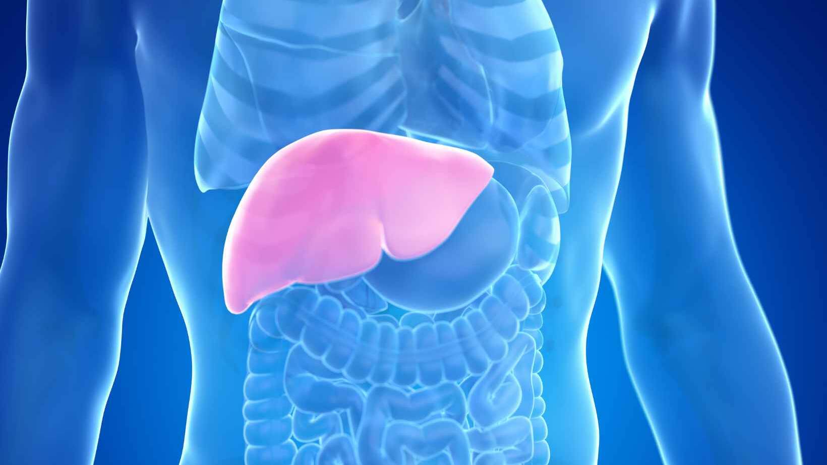 Primary Sclerosing Cholangitis Radiology Insights 16