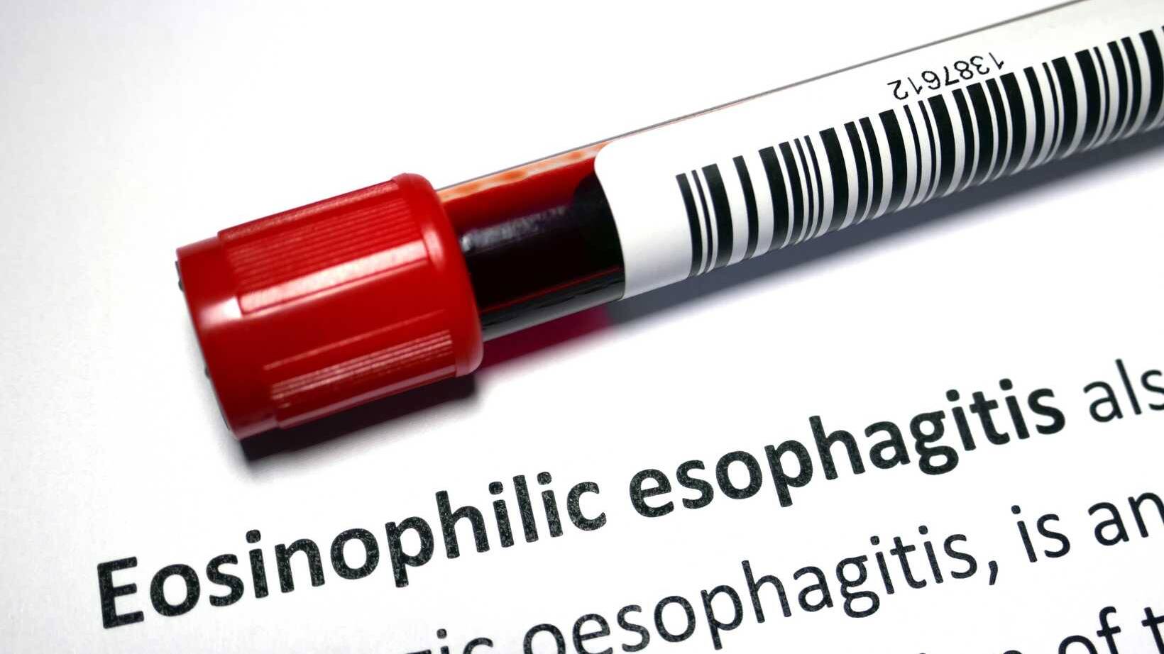 Symptoms Eosinophilic Esophagitis