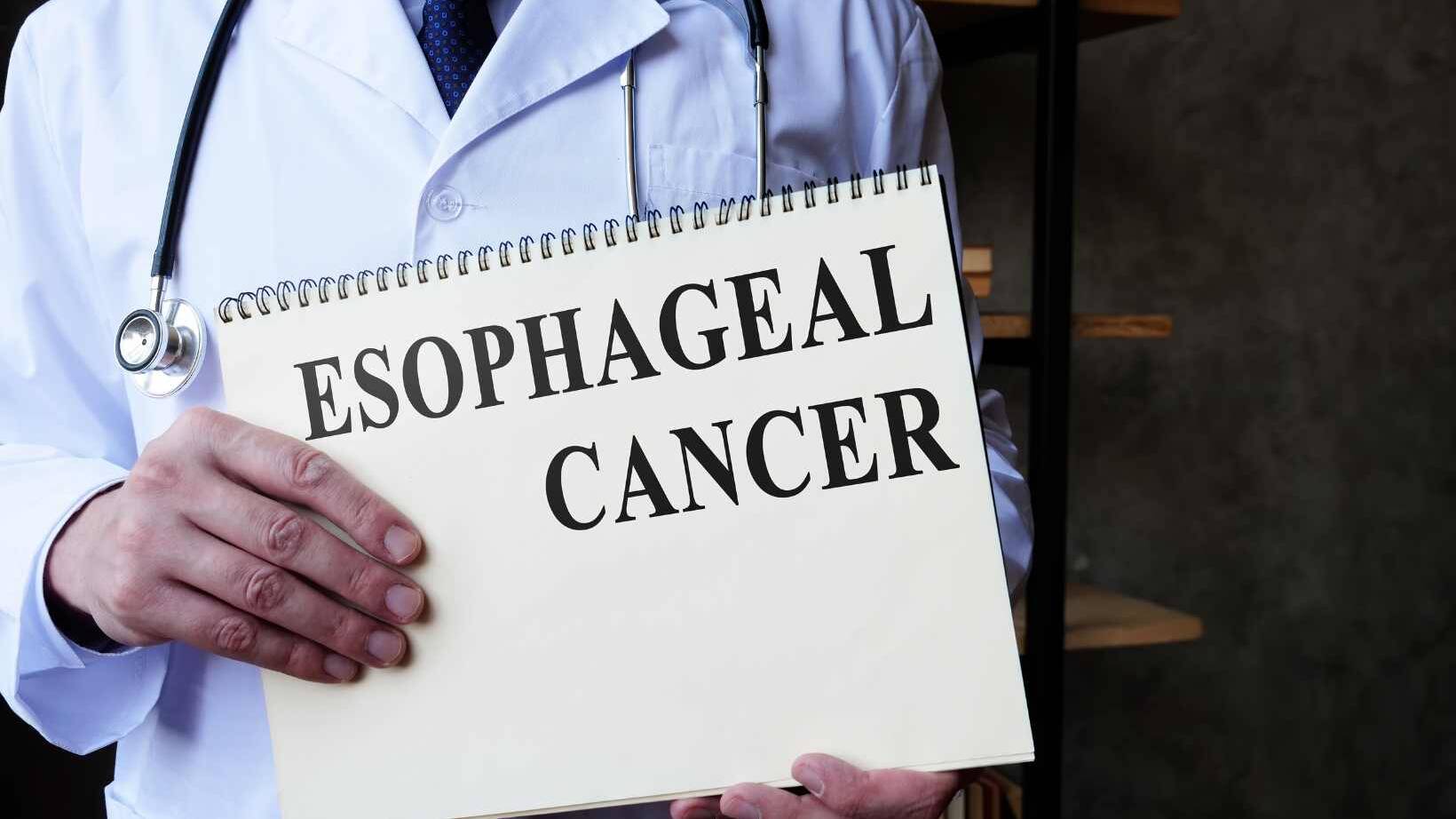 Treatment For Esophageal Cancer