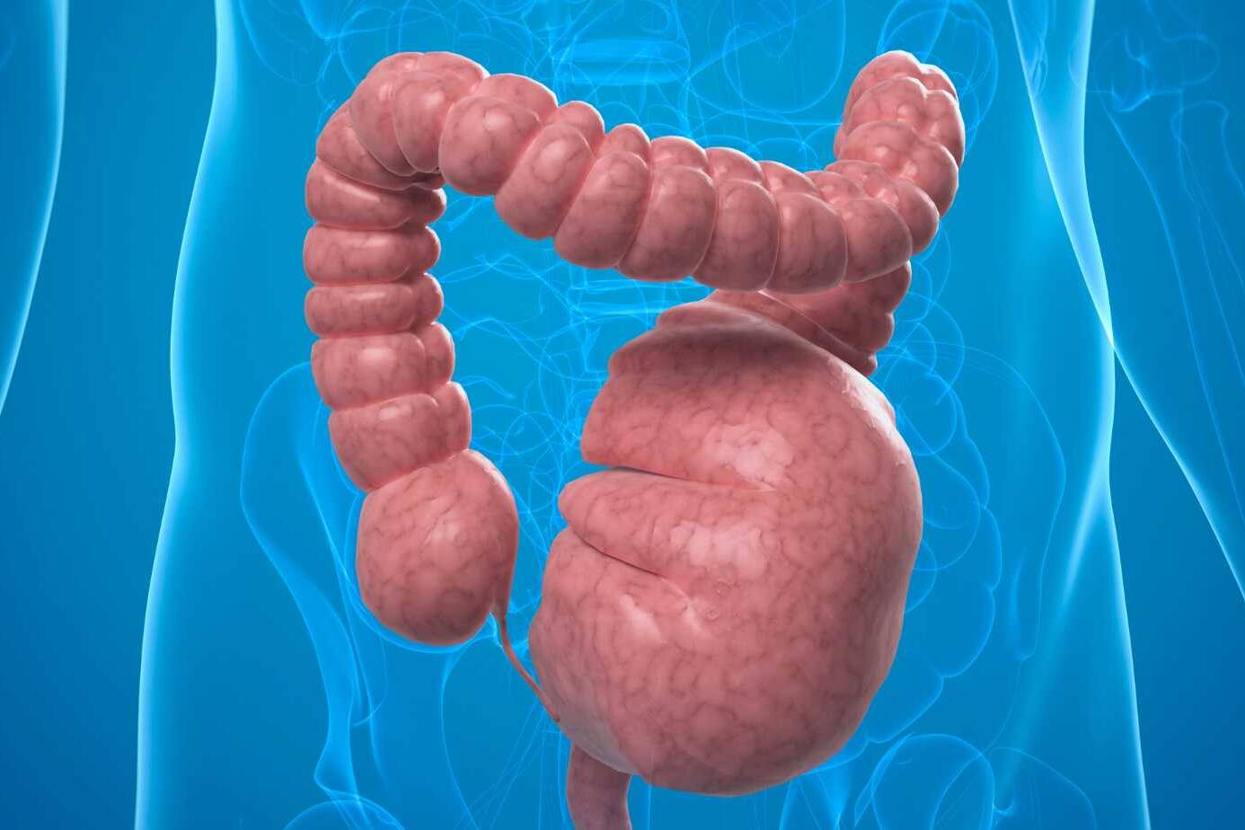 Effective Megacolon Treatment: Medical and Surgical Approaches to Management