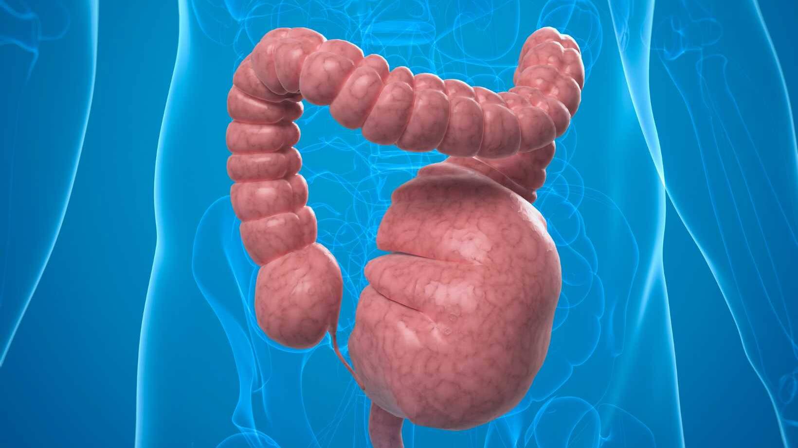 Effective Megacolon Treatment: Medical and Surgical Approaches to Management 15 Effective Megacolon Treatment: Medical and Surgical Approaches to Management