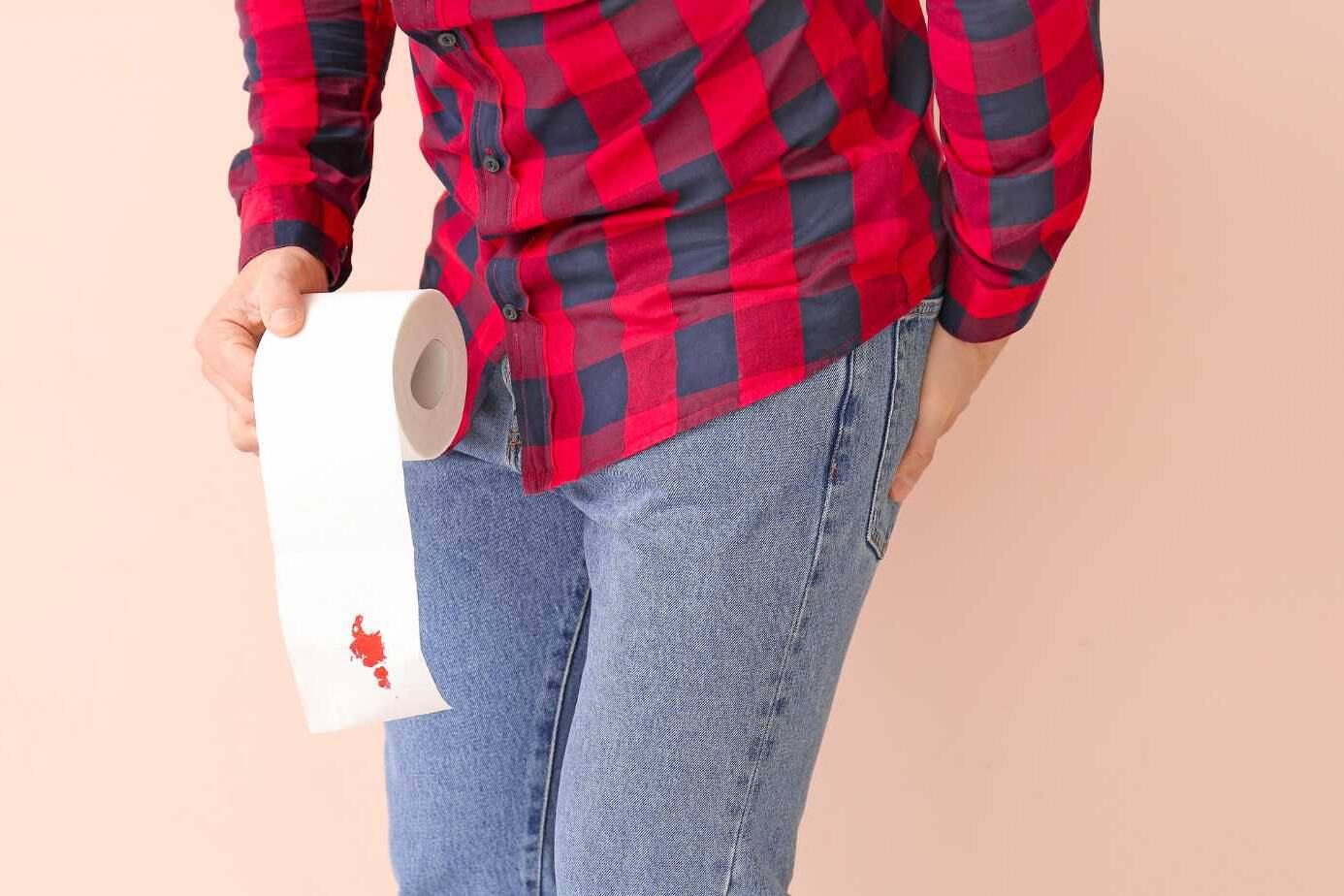 What Causes Rectal Cancer? Exploring Risk Factors and Prevention