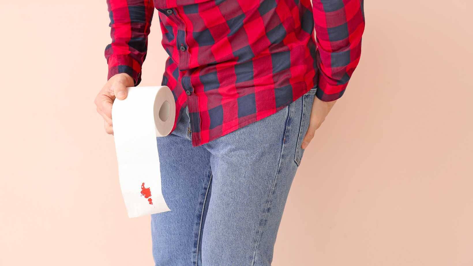 What Causes Rectal Cancer? Exploring Risk Factors and Prevention 12 What Causes Rectal Cancer? Exploring Risk Factors and Prevention