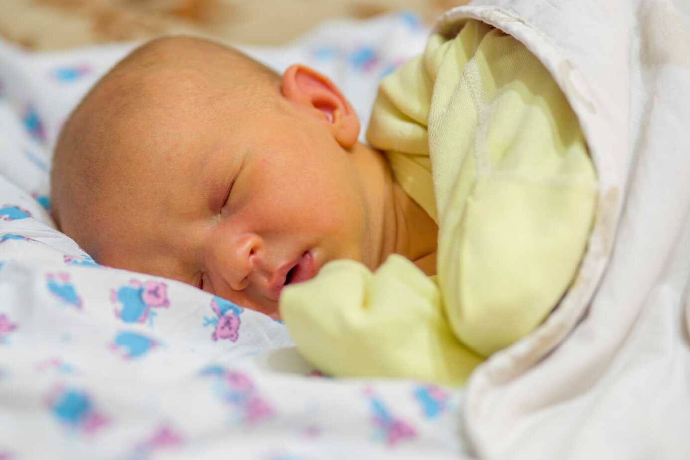 What is Jaundice in Babies