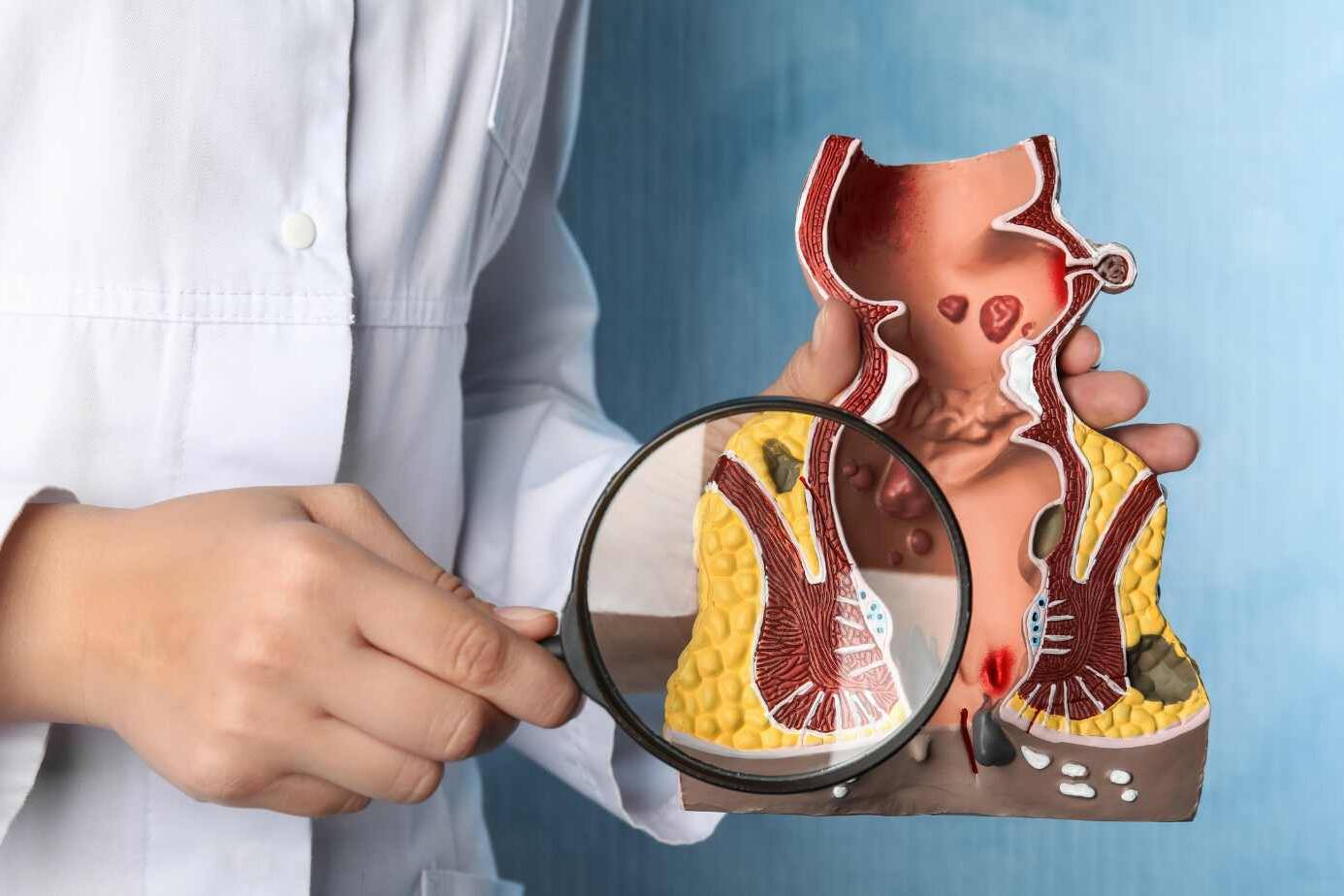 What is a Fistula? Understanding the Basics