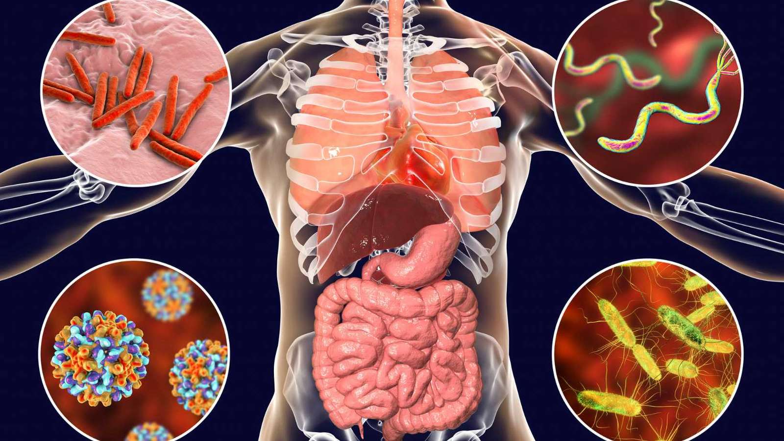 salmonella infection symptoms