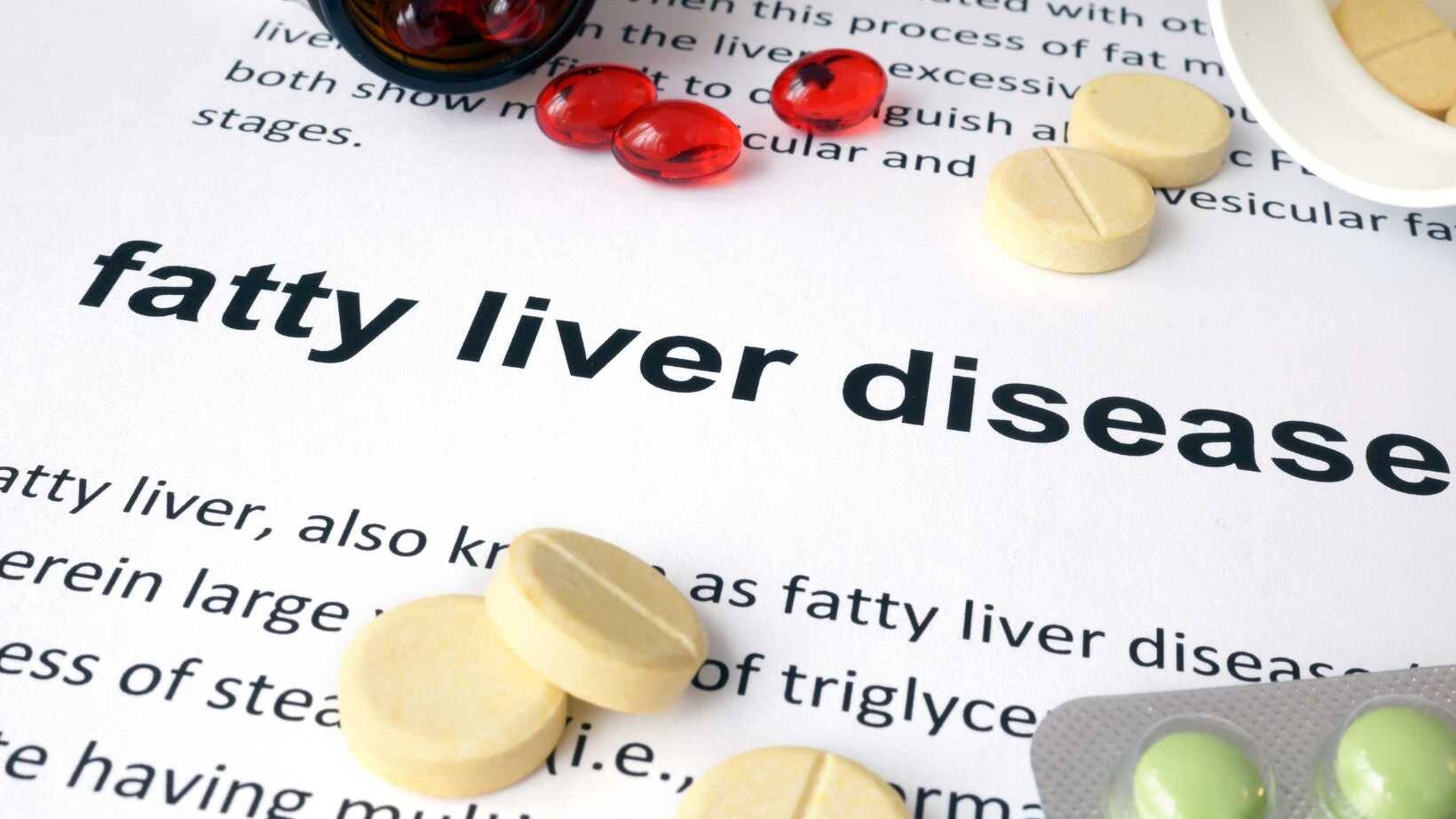 What Causes Nonalcoholic Fatty Liver Disease? Understanding Risk Factors and Prevention 17
