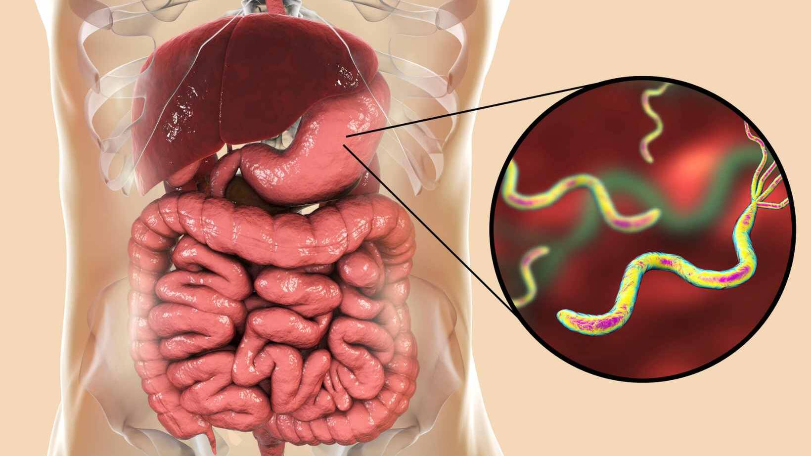 what is helicobacter pylori infection
