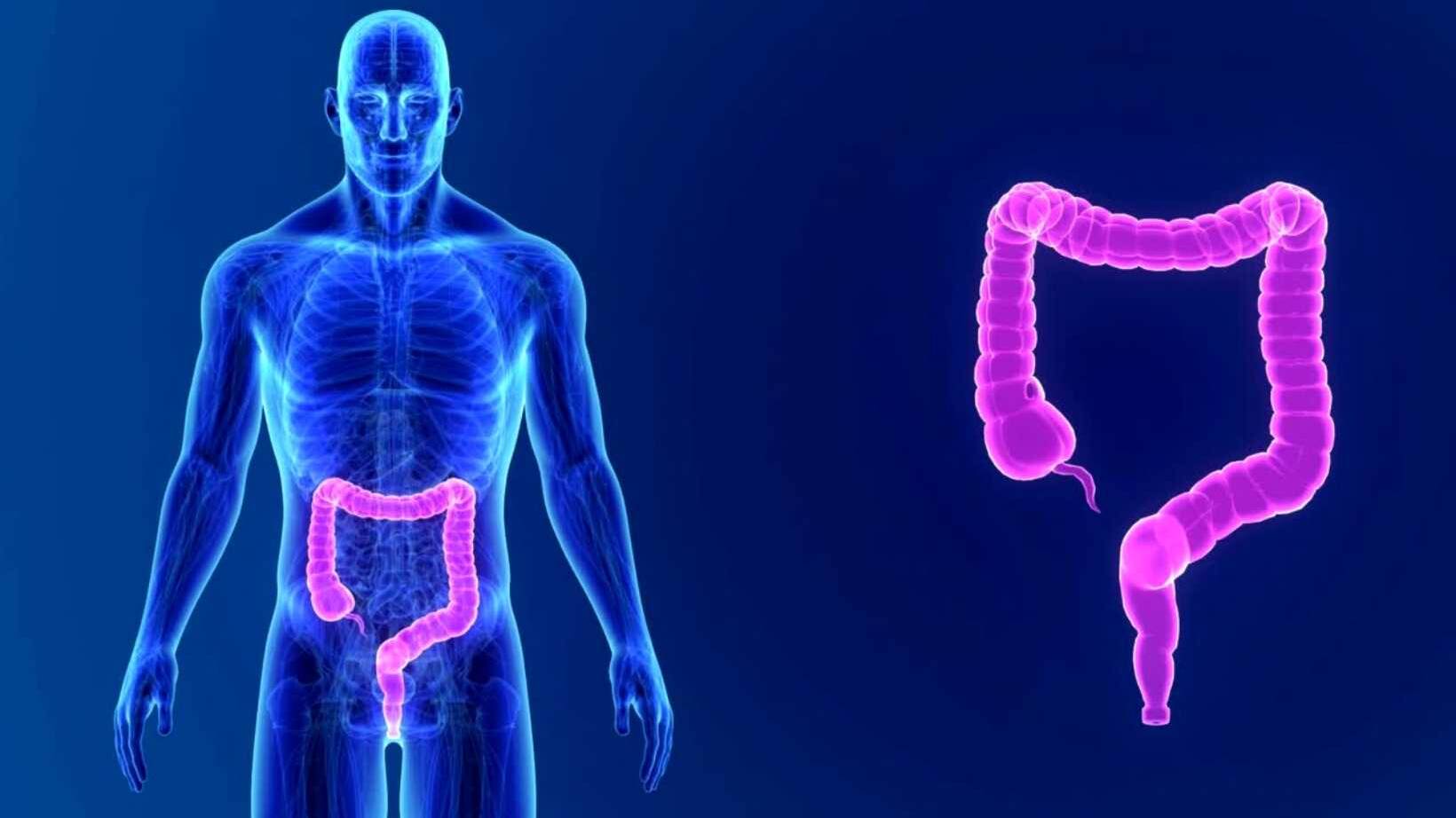 What Are Causes of Small Bowel Obstruction? Exploring Triggers and Risk Factors 8 causes of small bowel obstruction
