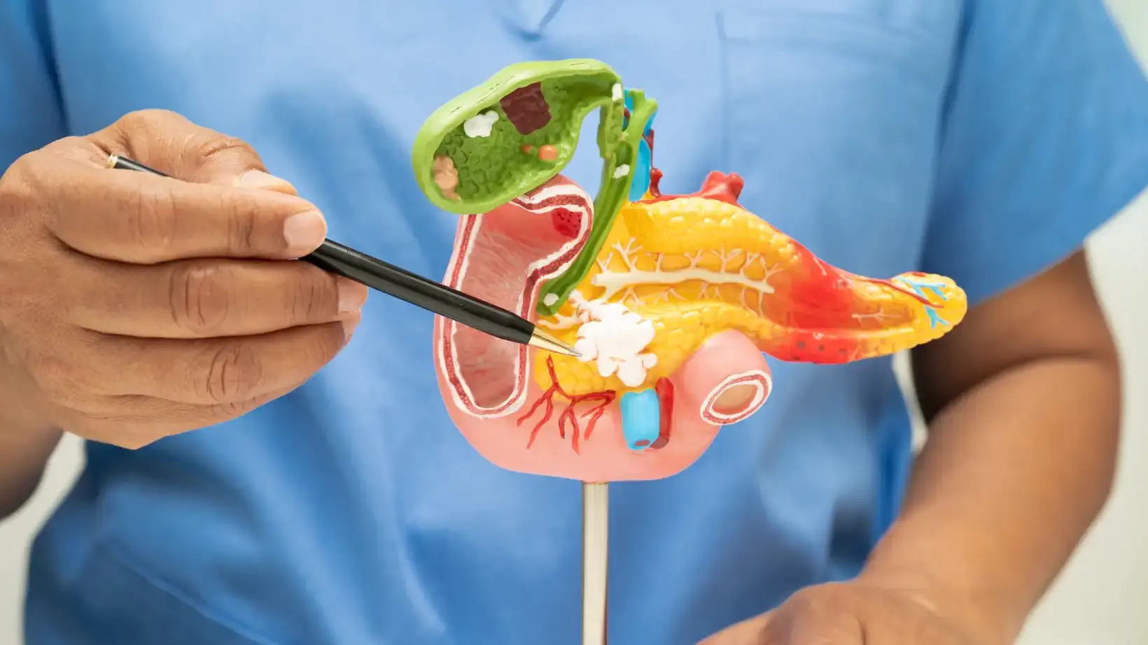 Should I Try a Gallbladder Cleanse? 4 gallbladder cleanse