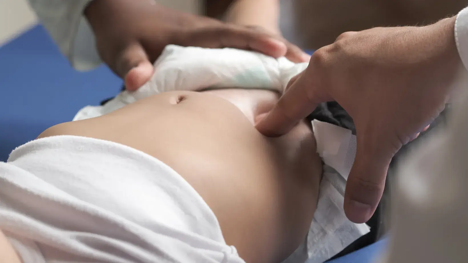 femoral vs inguinal hernia