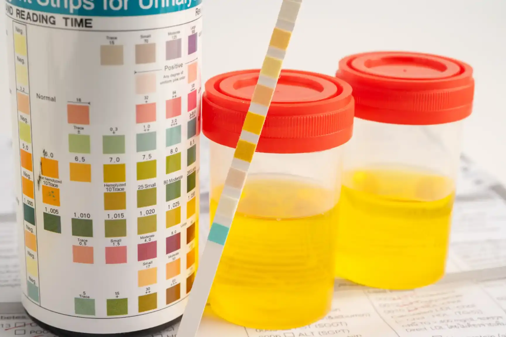 bilirubin in urine