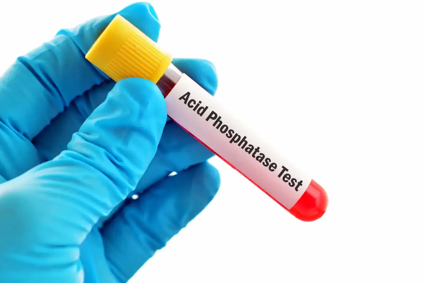 alkaline phosphatase levels
