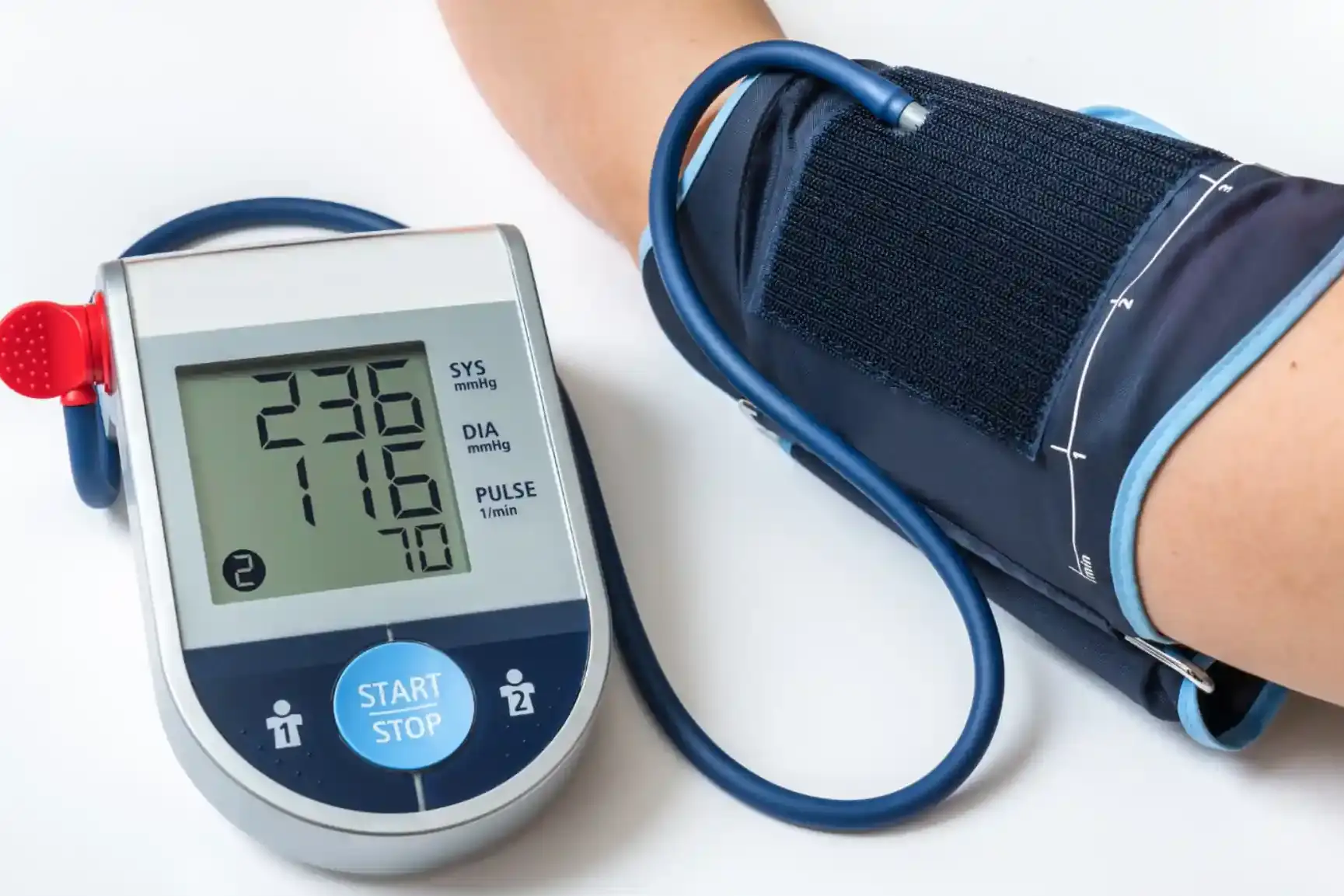 High Bilirubin Levels: Causes, Diagnosis, and Management 4 High Bilirubin Level