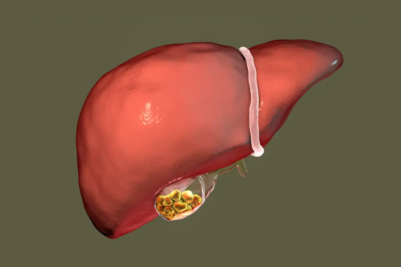 Liver Abscess: Symptoms, Causes, and Treatment 2 liver abscess
