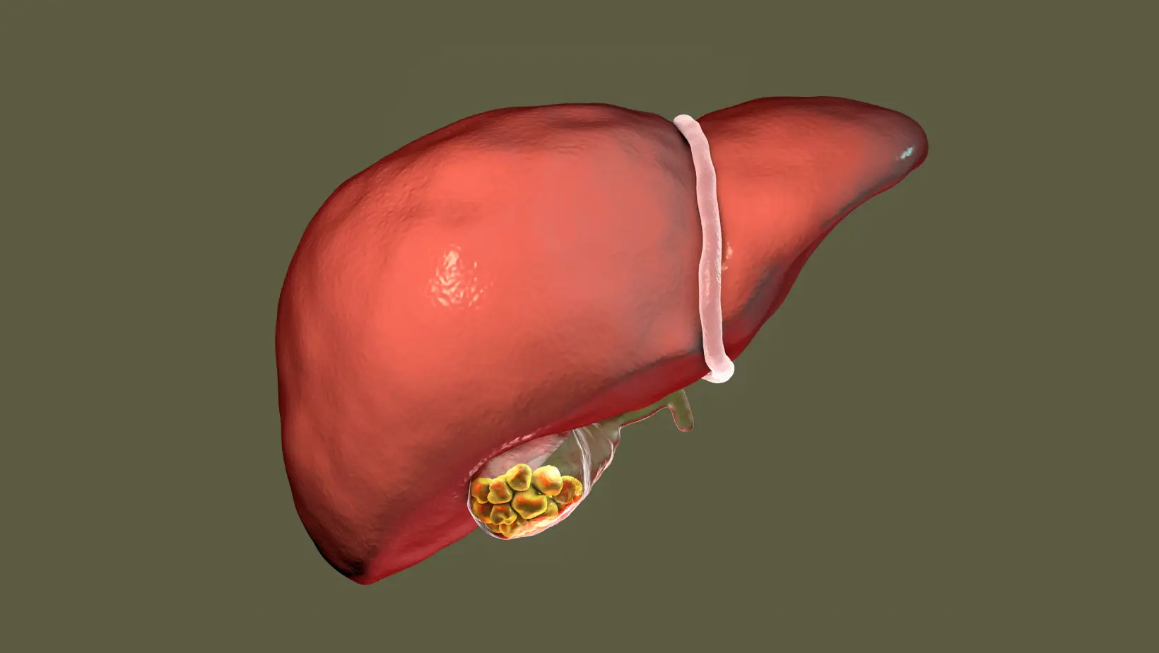 liver abscess