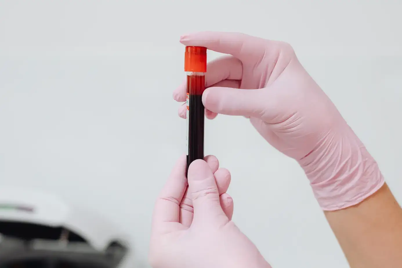 liver function test normal range