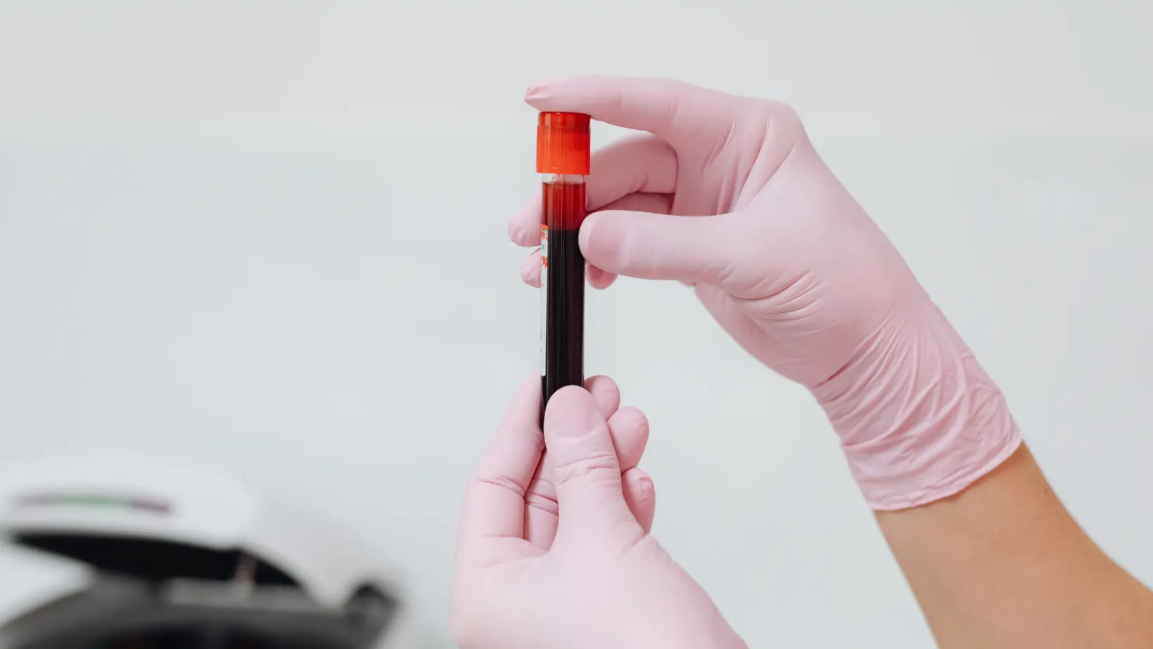 liver function test normal range