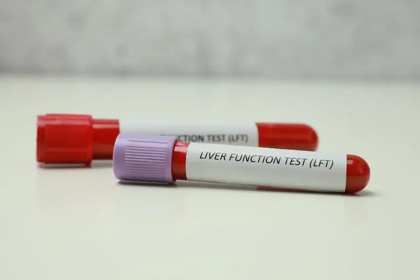 hepatic liver function panel​