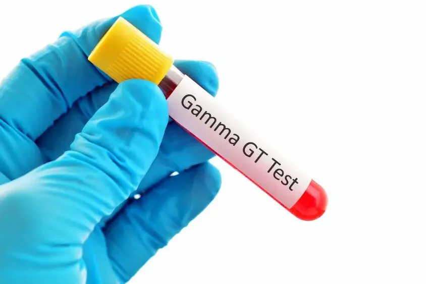 high ggt blood test