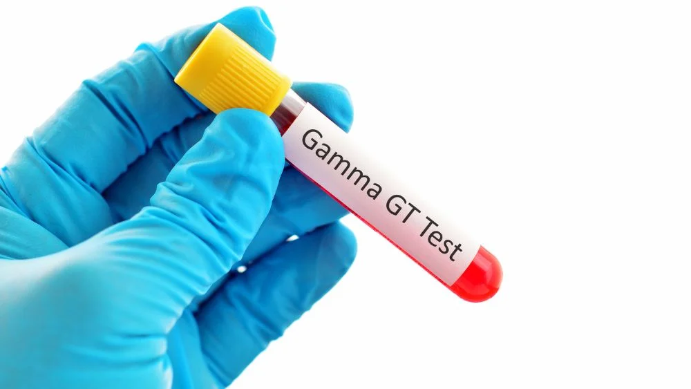 High GGT Blood Test: Causes, Symptoms, and What It Means 8 high ggt blood test