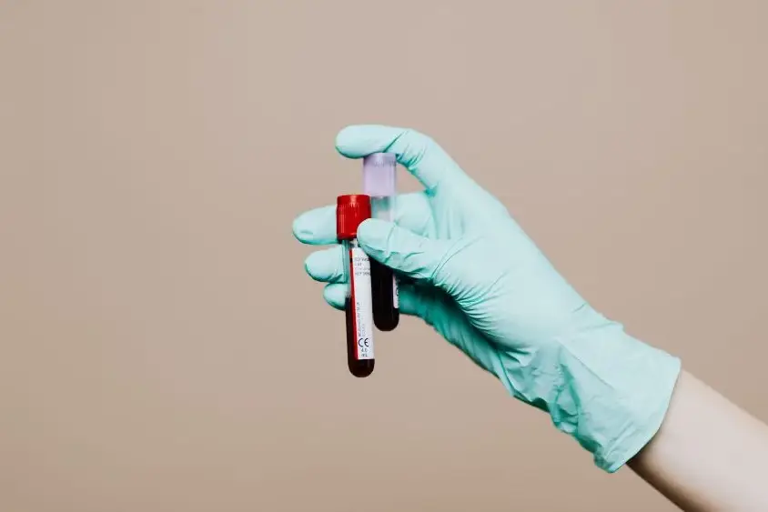 normal ranges of alt​