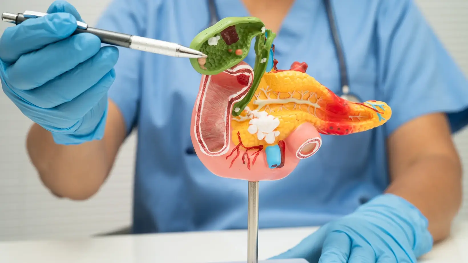 Symptoms of Gallstones: Warning Signs You Should Not Ignore 2 symptoms of gallstones